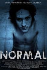 Normal