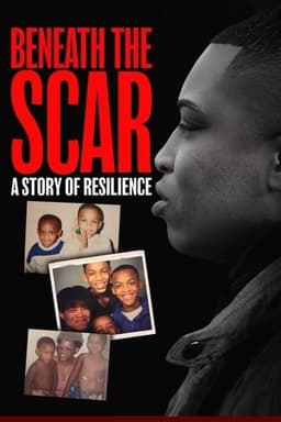 Beneath the Scar: A Story of Resilience